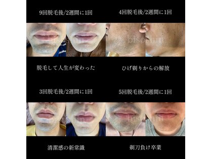 美痩身(bisoshin)の写真