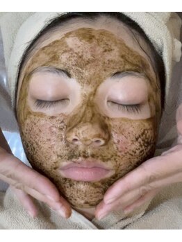 アールエム ボーテ(RM beaute')の写真/ニキビに寄り添うハーブピーリング+プラズマで、お肌を綺麗にしたい!♪