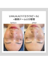 ポムハヌル(pom.haneul)/韓国肌管理室