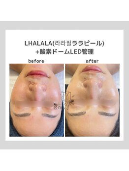 ポムハヌル(pom.haneul)/韓国肌管理室