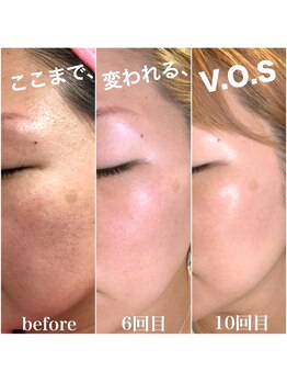 ビューティーガーデン(beauty garden)/