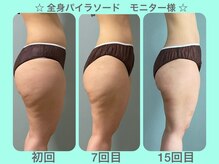 ビーナイス ビューティー(Be Nice Beauty)/★ セル脂肪の変化 ★