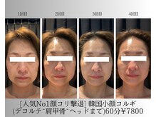 ベルフルール 西18丁目店/韓国小顔コルギ