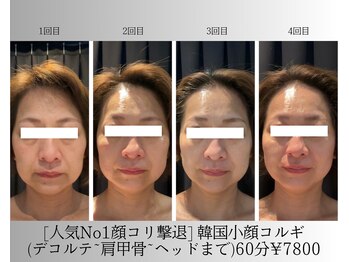 ベルフルール 西18丁目店/韓国小顔コルギ