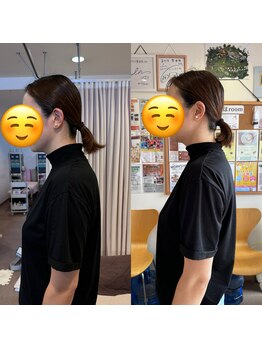 カイロプラクティック ネクサス/ストレートネックと頭痛撃退☆