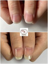 ネイルカフェ ナナ(nailcafe'nana)/自爪育成