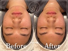 R-1ビューティーサロン 表参道/Before＆After