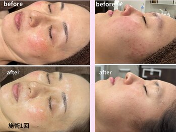 ビープラス(Biplus)