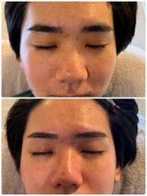 スリーピース(3Peace)/Before/After