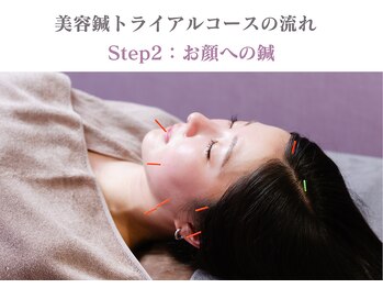 シー バイ カリスタ 渋谷店(C by CALISTA)/美容鍼トライアルコースの流れ