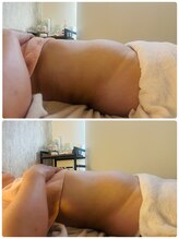 ナチュラルビューティラテ(NATURAL BEAUTY LATTE)/腸もみ