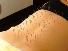 泰然の雰囲気（鍼が初めての方多数◎施術経験豊富な鍼灸師が施術！腰痛コリに◎）