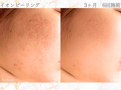 アクール(Accueil)の写真