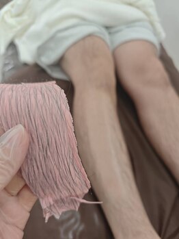 アルマサロン 菊陽(Almasalon)/両ひざ＋ふくらはぎWAX脱毛