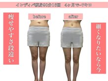 エステサロン ヴリエ 立川店/全身痩せ★インディバで根本改善