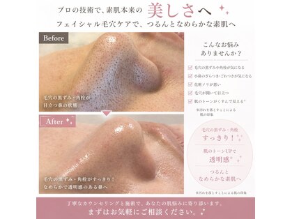 ｂｅｂｅの写真
