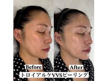 エミリエボーテの雰囲気(お客様に合ったコースをパーソナライズでご提案させて頂きます。)