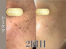 アールビューティー(R-beauty)