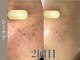 アールビューティー(R-beauty)の写真