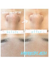 デジール(DESIR)/毛穴汚れが目立つ方におすすめ