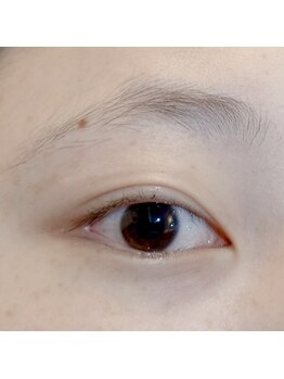 ビビデバビデ(Vivide Vavide)/【眉+マツパ同時施術】before