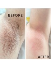 ケトリーナ/ブラジリアンワックス　ワックス