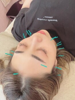 ヒーリングサロン アージュ(A-je)/★美顔鍼＋小顔矯正★