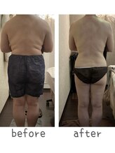 トモズサロン28(Tomos.salon.)/痩身・サイズダウン！