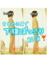 ヴェール 青山(vert)/骨盤矯正ビフォーアフター