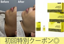 アンド(and...)