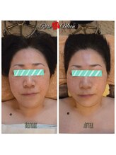 ローズムーン(Rose.Moon)/コルギ６０分コース