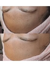 バリューネクスト 青葉台/◆最新マンデルホワイトピール◆