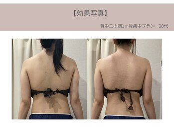 ミライ 福岡筑紫野店(mirai)/ブライダル☆1カ月プラン