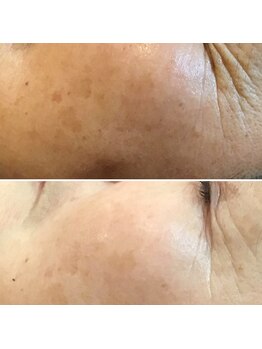 骨盤ダイエットサロン カンフリエ(camphrier)/ダクトピール