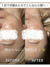 リュミエール(Lumiere)/透明感フェイシャル