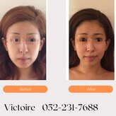 ヴィクトワール(Victoire)