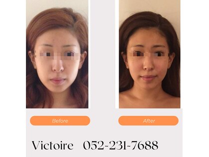 ヴィクトワール(Victoire)の写真