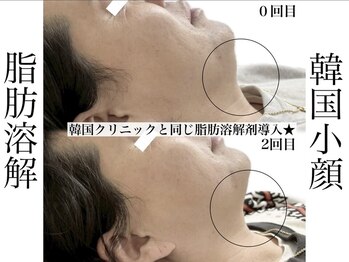 エステティック リベル キョウト 京都駅前店(Esthetic Liber Kyoto)/韓国小顔コルギ×脂肪分解