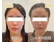 ビーキュート 姫路店(BE-CUTE)の写真