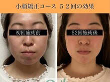 キュープ 表参道店(Qpu)/続けた方しか感じられない変化♪