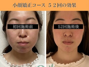キュープ 表参道店(Qpu)/続けた方しか感じられない変化♪