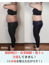 バストラボ 仙台店/骨格を整えるだけです！