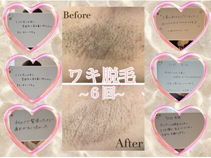 スゥ(Suu)の写真