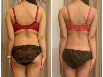 アンベリーノ/シータ波全身マッサージ