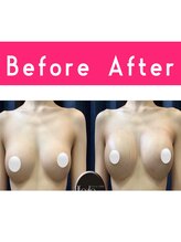 エルフラージュ 銀座店/トップ3.5センチUP