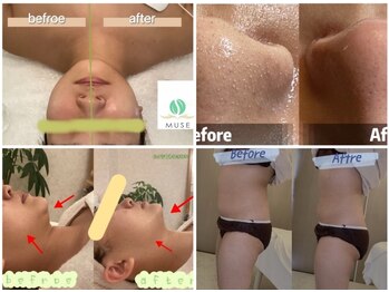 ミューズ 成城(MUSE)