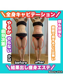ビューティ ウィッチ(Beauty Witch)/ダイエットなら当店で決まり