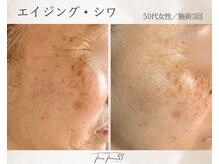 スリースリー(THREE THREE)/エイジング・しわケア