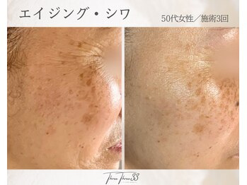 スリースリー(THREE THREE)/エイジング・しわケア