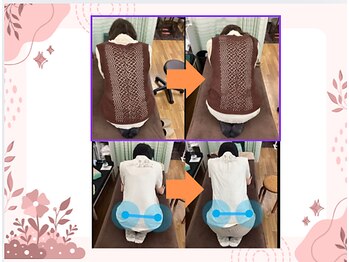 伏見一心整体院/整体前後のビフォーアフター